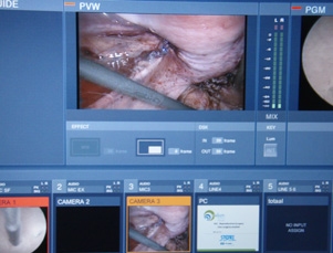 Mixing endoscopic and other video images from 3 operating theatres in Leuven